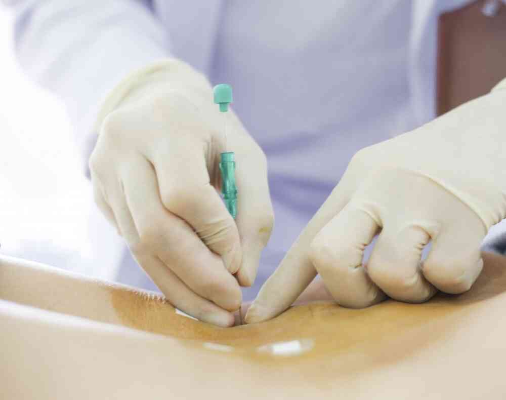 Bác sĩ thực hiện kỹ thuật cấy chỉ vào huyệt đạo trị liệu đau xương khớp