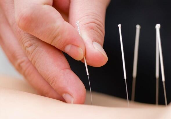 Bác sĩ thực hiện kỹ thuật châm cứu trị liệu giảm đau và đả thông kinh lạc